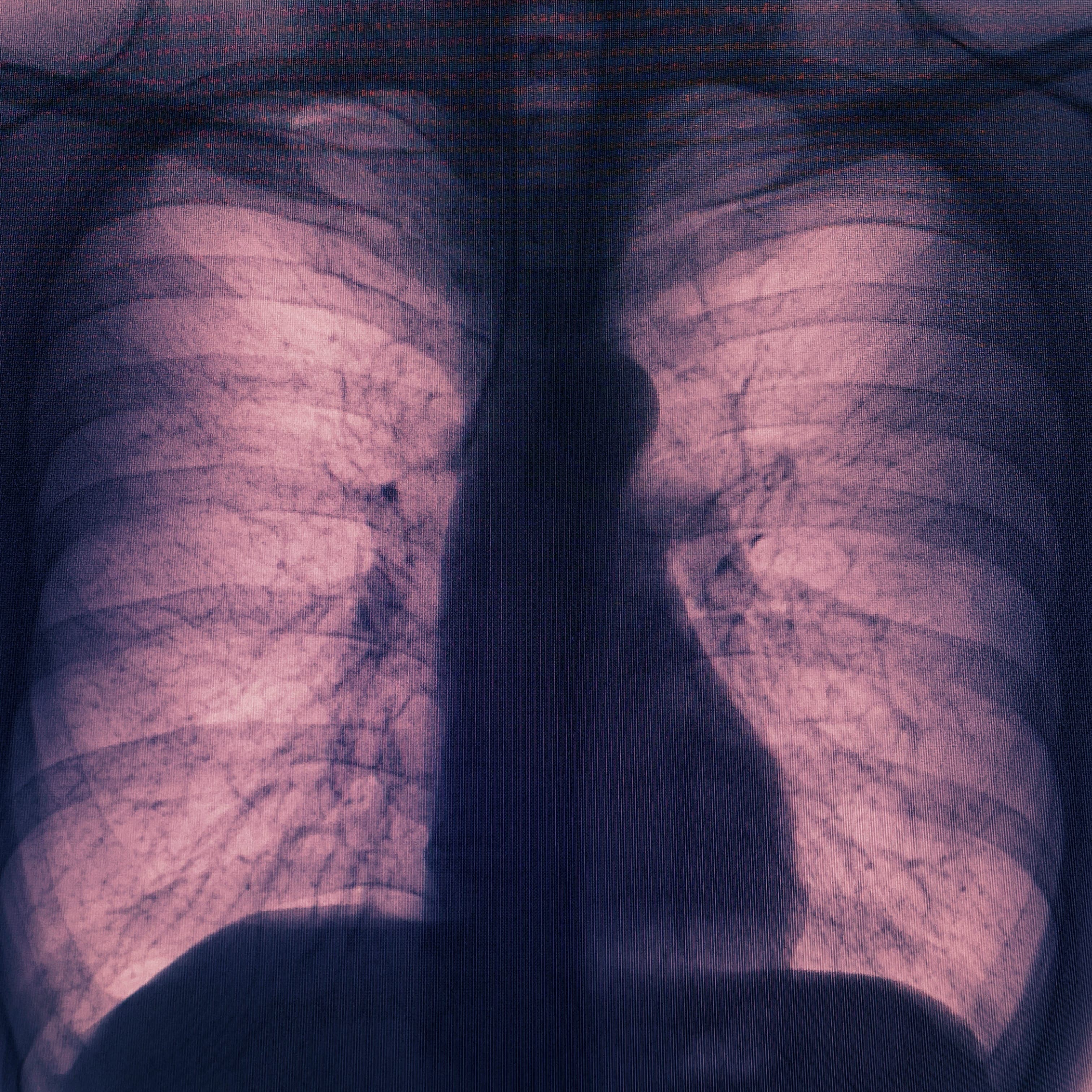 Blurred release artwork background