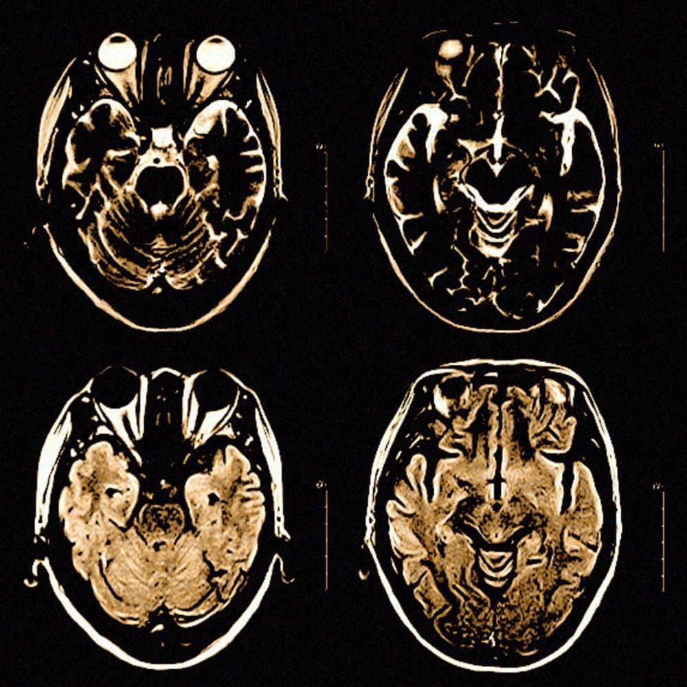 Blurred release artwork background